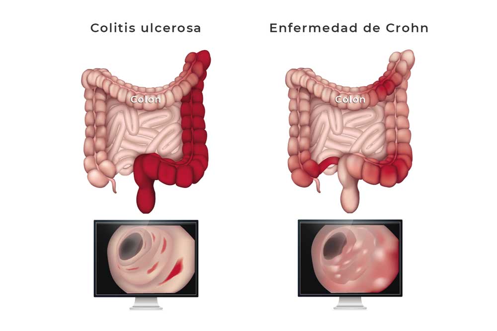 Toda Enfermedad Comienza En El Intestino Toda Enfermedad Comienza En