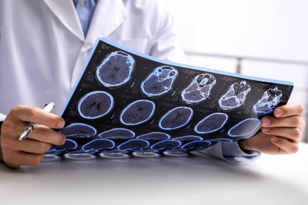 Esclerosis múltiple tratamiento neurólogo en Córdoba