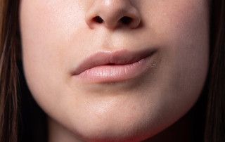 Parálisis facial o de Bell, tratamiento en Córdoba - Especialista
