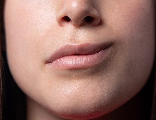 Parálisis facial: tratamientos avanzados y cuándo optar por cirugía