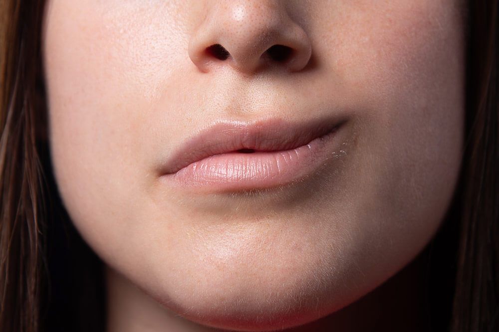 Parálisis facial o de Bell, tratamiento en Córdoba - Especialista