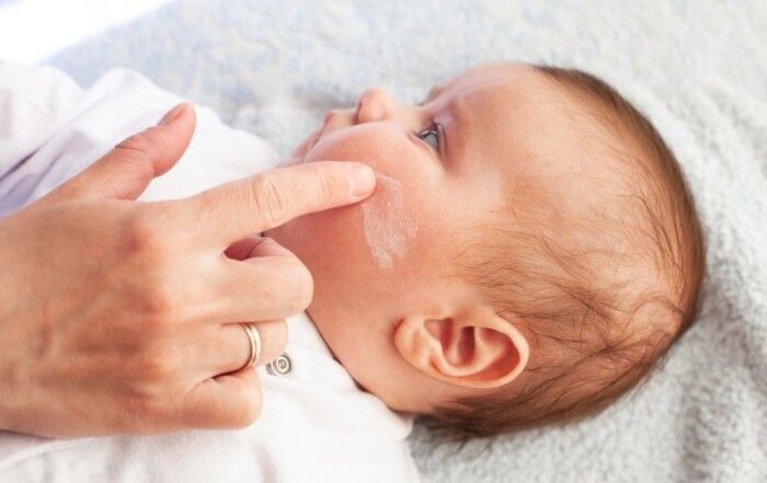 Cómo cuidar piel atópica durante el baño, recomendaciones médicas
