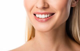 Carillas dentales en Córdoba para sonrisa perfecta, tratamiento dental