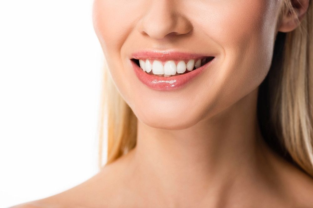 Carillas dentales en Córdoba para sonrisa perfecta, tratamiento dental