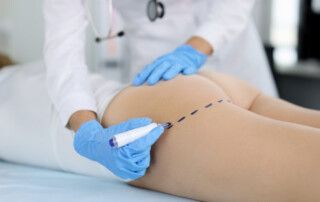 Aumento de glúteos en Córdoba | Hospital Cruz Roja | Solicite cita