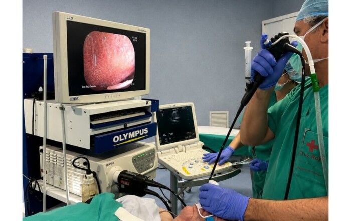 Procedimiento EBUS realizado por el equipo de Neumología del Hospital Cruz Roja de Córdoba para el diagnóstico del cáncer de pulmón